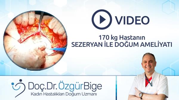 170 KG HASTANIN SEZERYAN İLE DOĞUM AMELİYATI