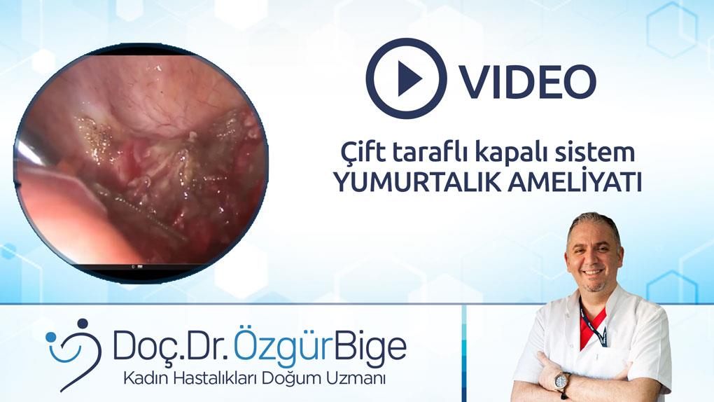 Çift taraflı kapalı sistem YUMURTALIK AMELİYATI