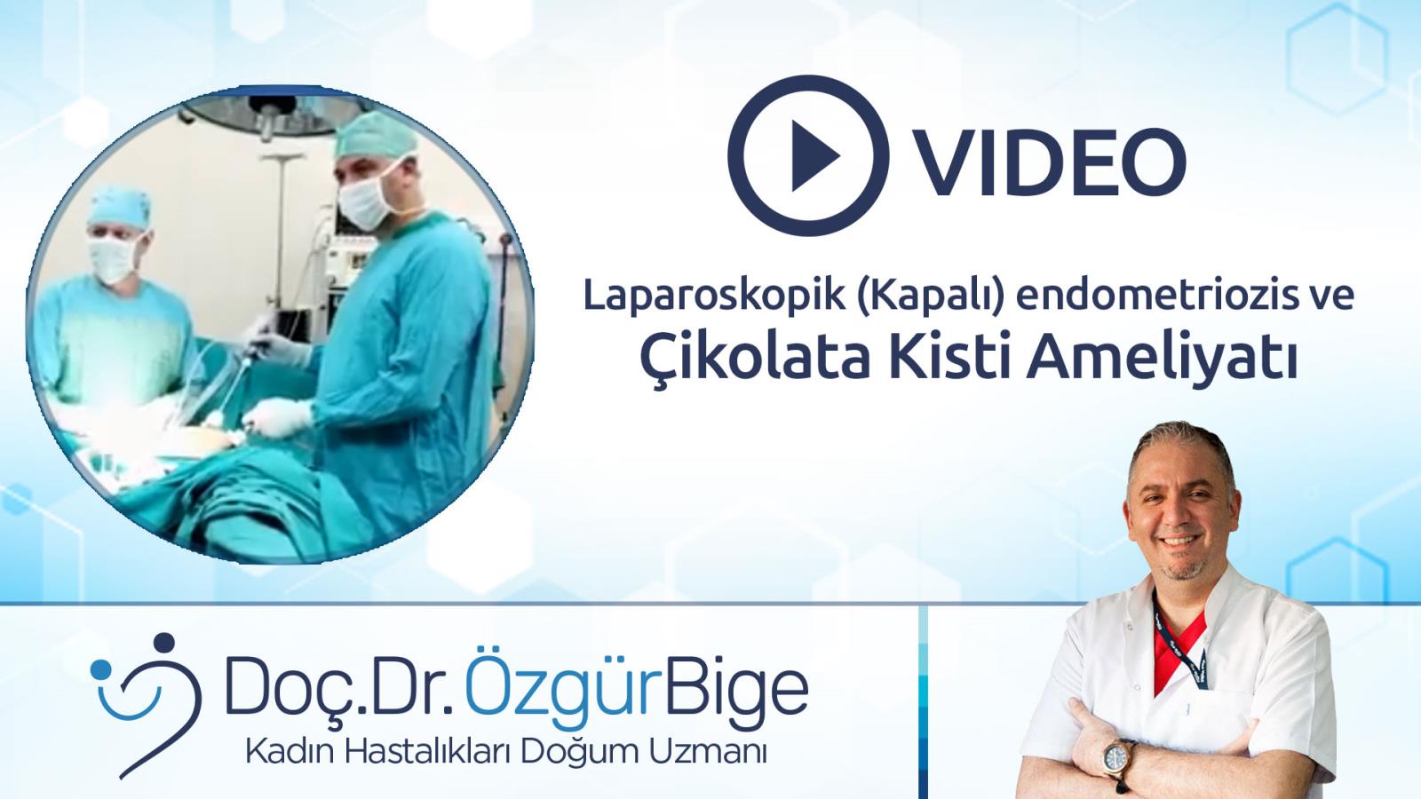 Kapalı Laparoskopik Endometriozis ve Çikolata Kisti Ameliyatı